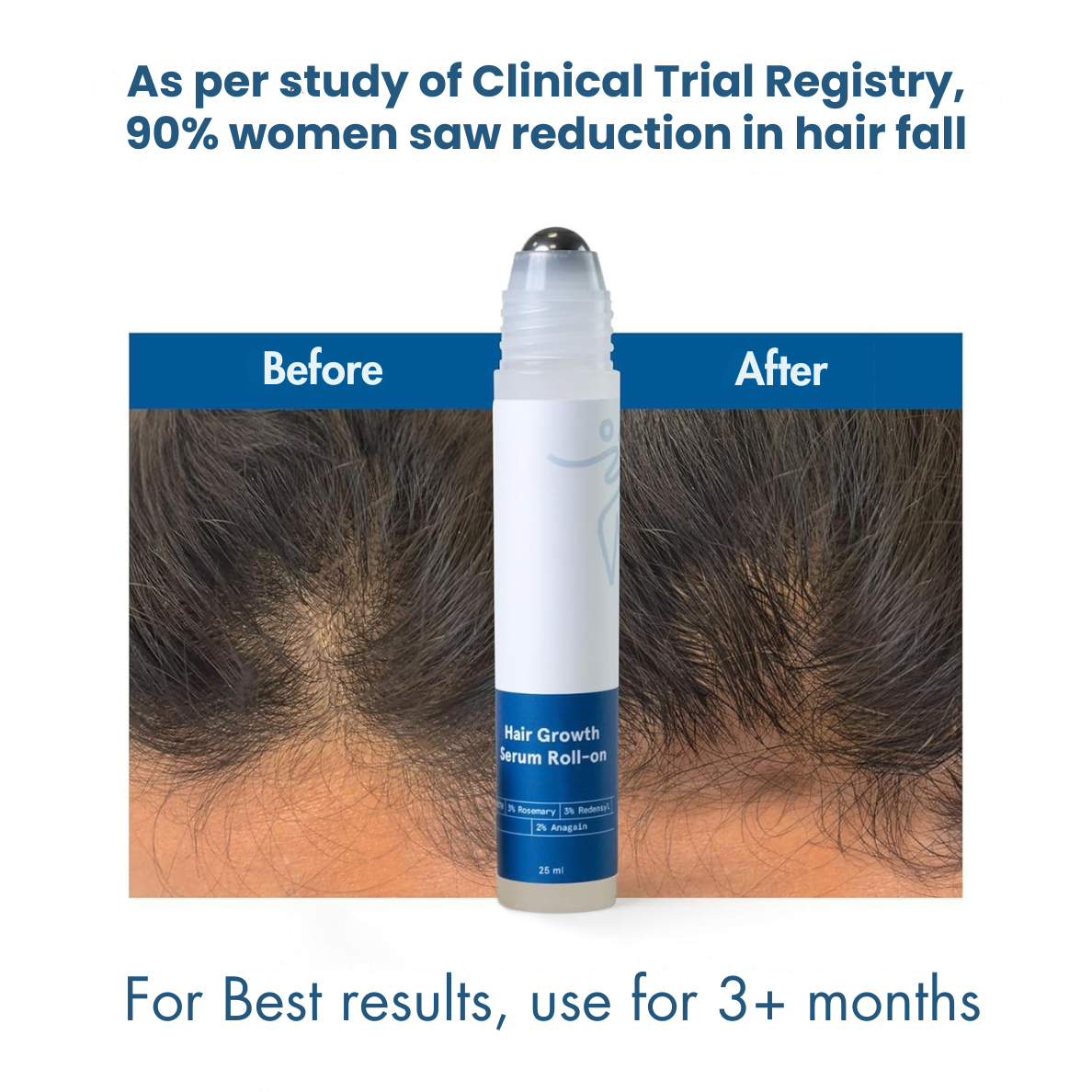 RootReclaim™ – Hair Growth Serum Roll-On