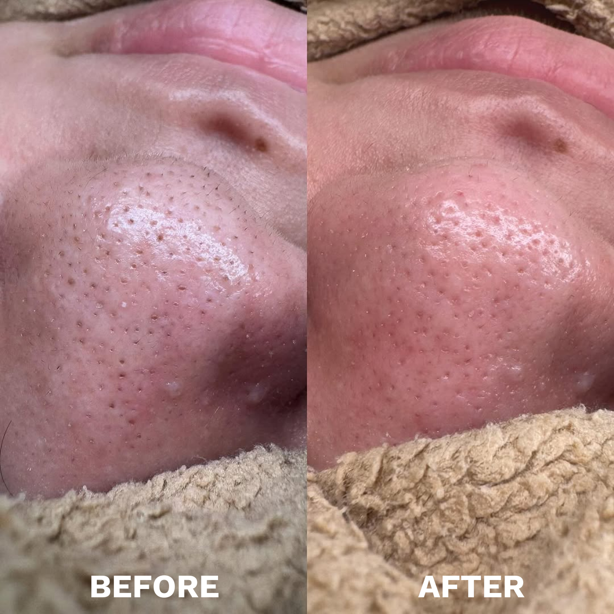 Mung Bean Skin Detox Duo