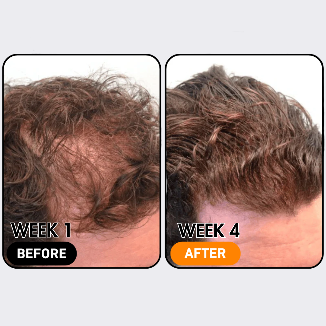 SylkRoot™ Activator Shampoo