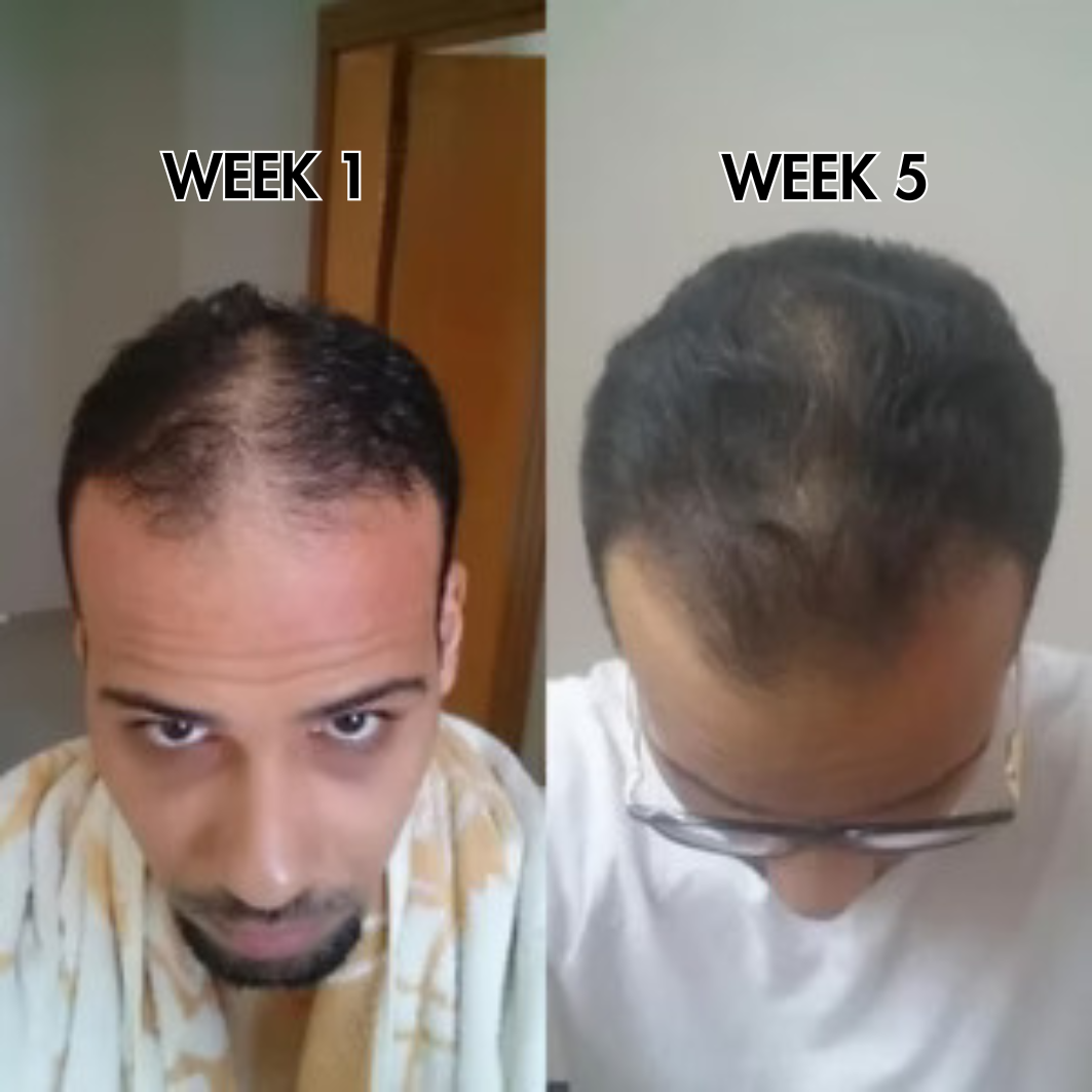 SylkRoot™ Activator Shampoo