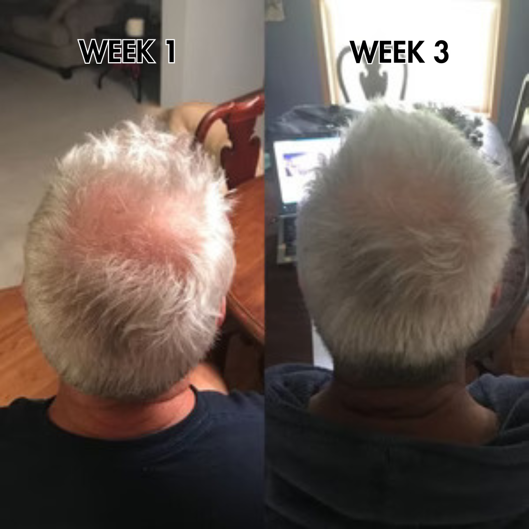 SylkRoot™ Activator Shampoo