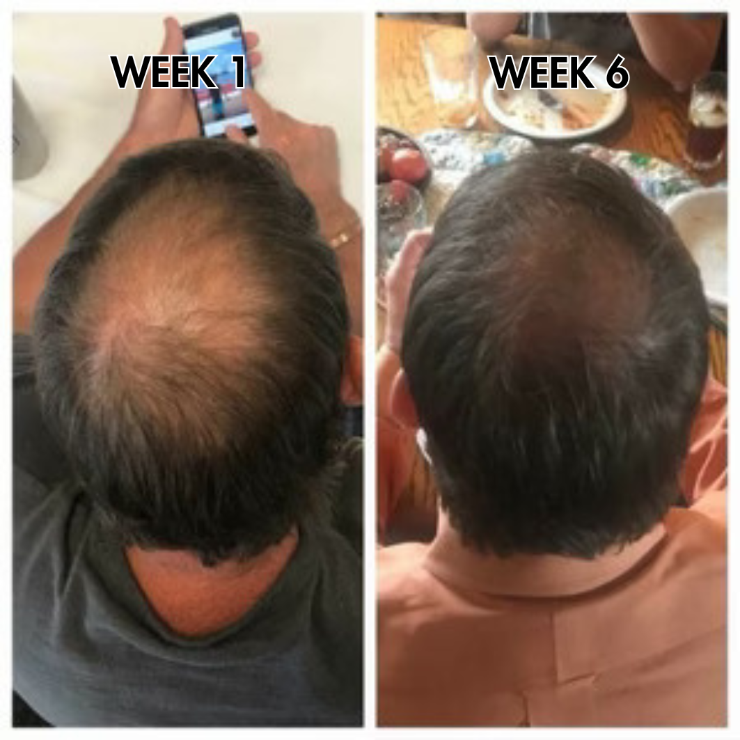 SylkRoot™ Activator Shampoo