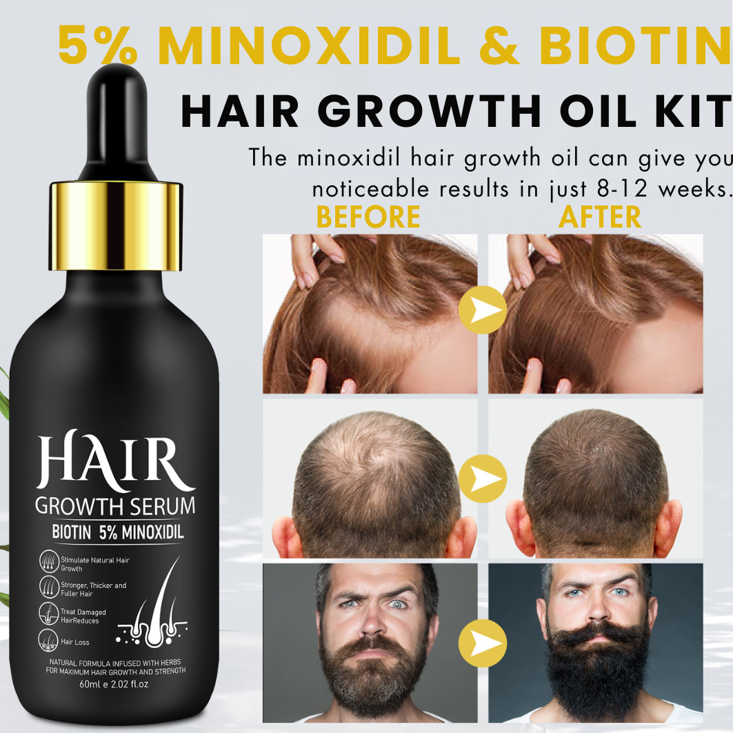 GrowthFuel™ – Hair & Beard Serum 5% Minoxidil
