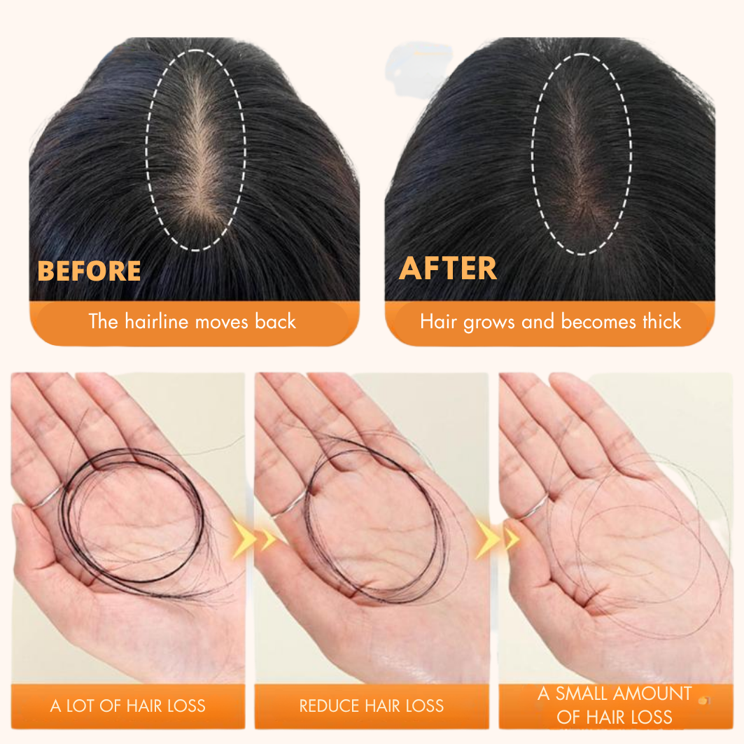 RootReclaim™ Hair Growth Shampoo
