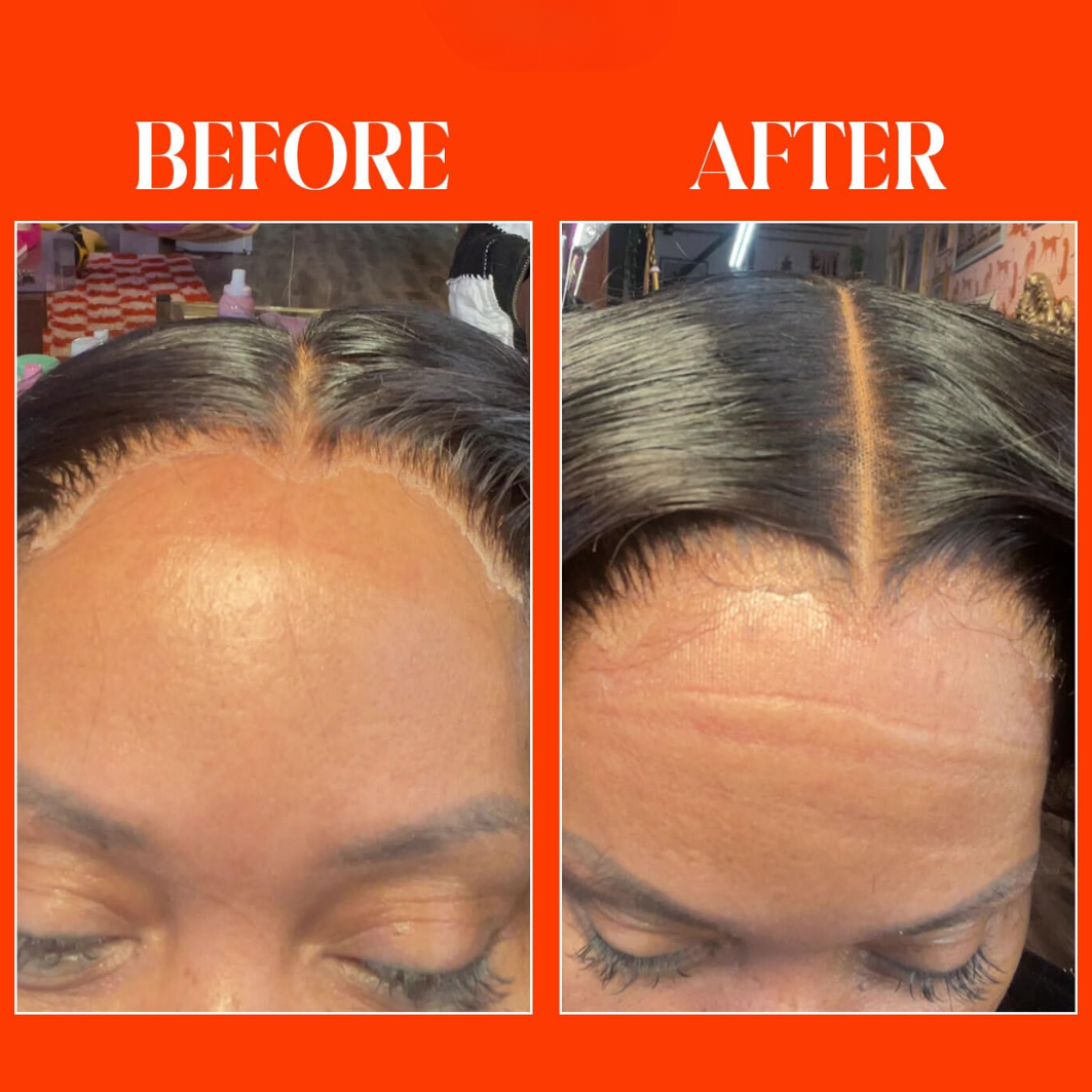 MeltGuard™ Lace Spray — Flawless Melt, No White Cast