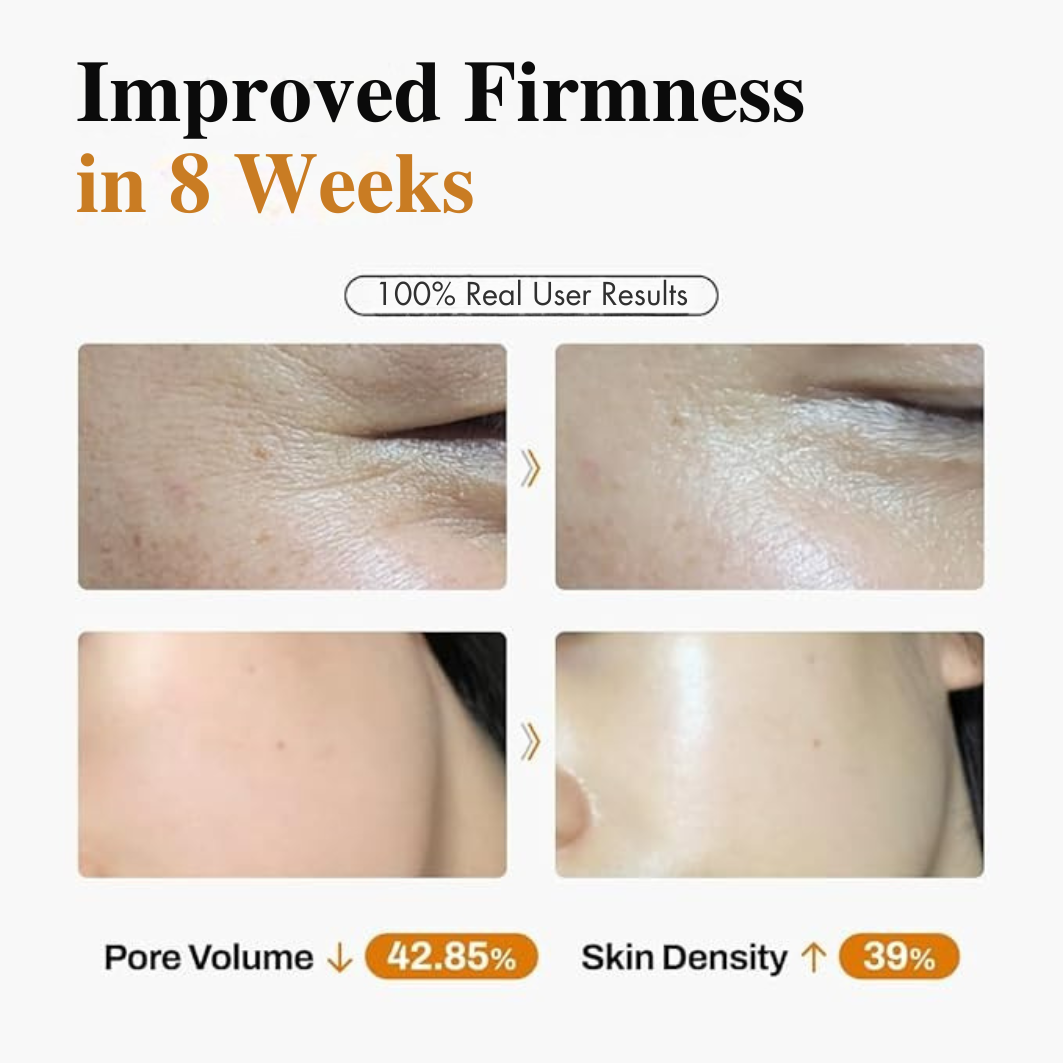 DermiShuttle™ Lifting Kit