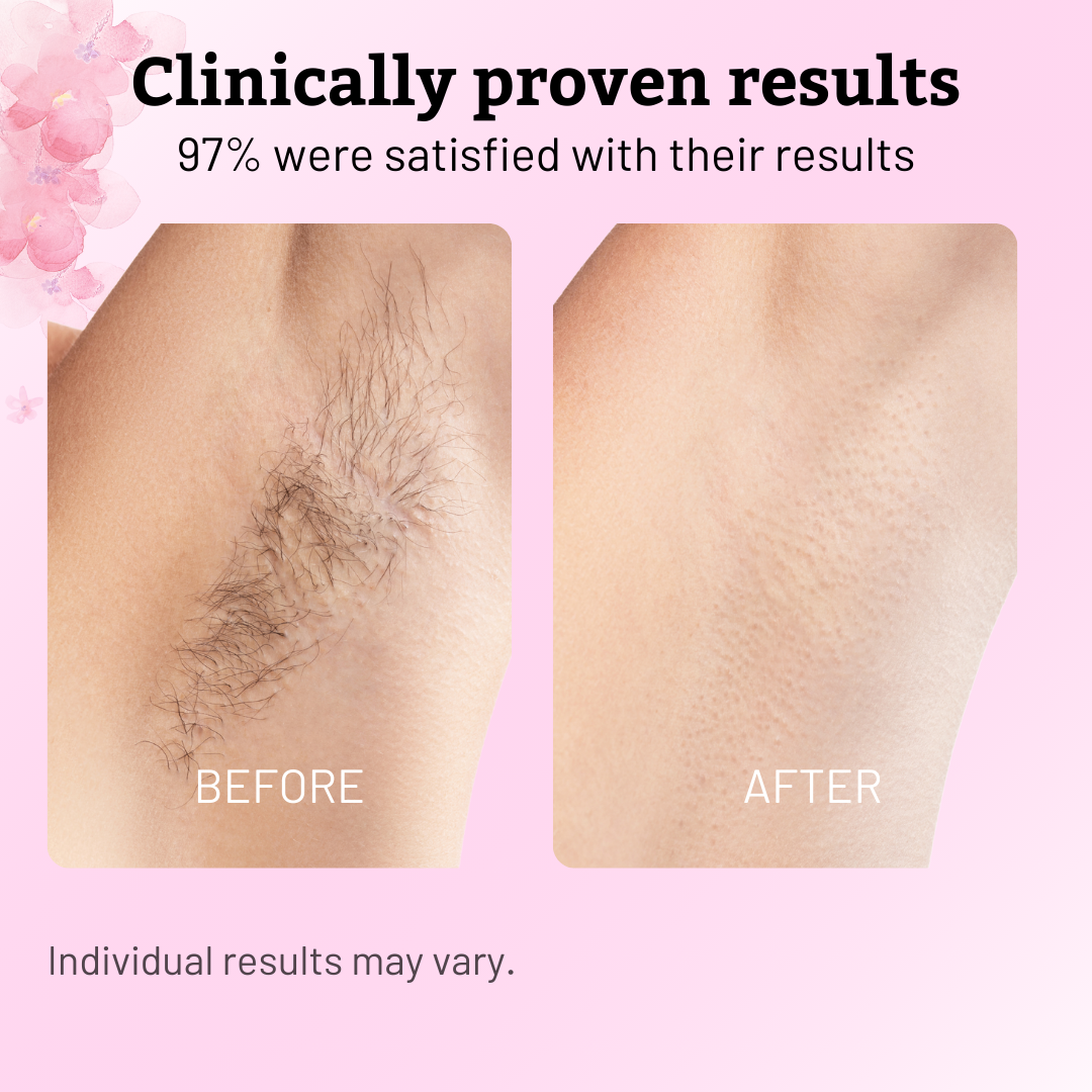 Nudae™ - Oil for Natural Permanent Hair Reduction