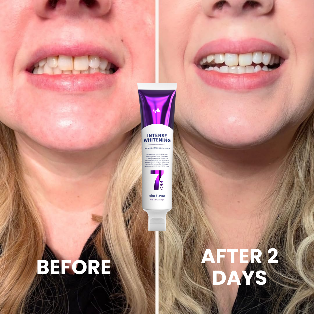 WhiteSmile Probiotic