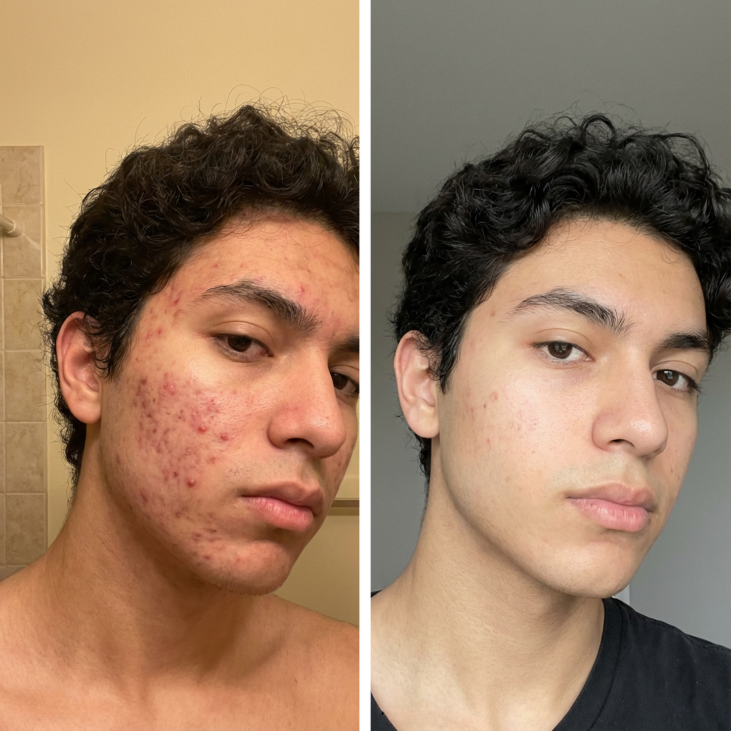 ClearTrace™ Azelaic Correcting Serum