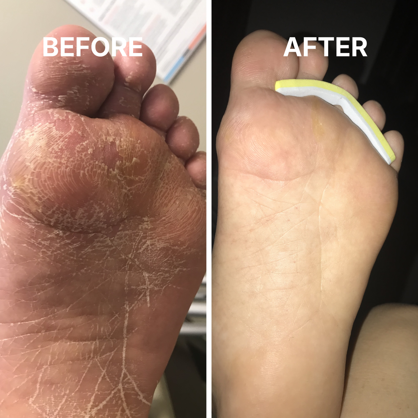 SkinFix - Target cracked, rough skin fast. Wake up to softer skin.