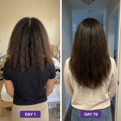Hair Skin Nails+ Gummies 9-in-1