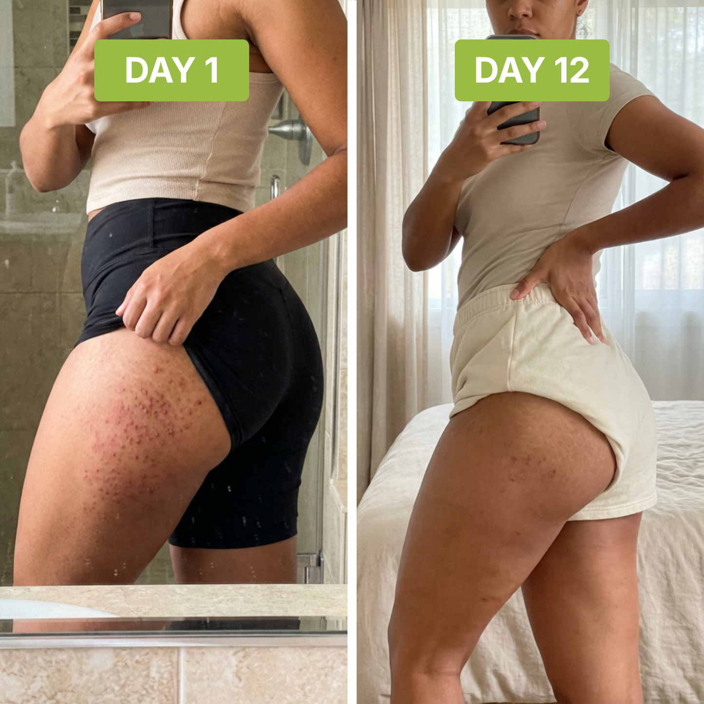 ClearSkin™ - Stops bumps and ingrowns at the source.