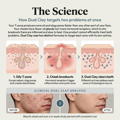 Dual Clay Stick - For Blackheads & Acne