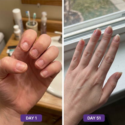 Hair Skin Nails+ Gummies 9-in-1