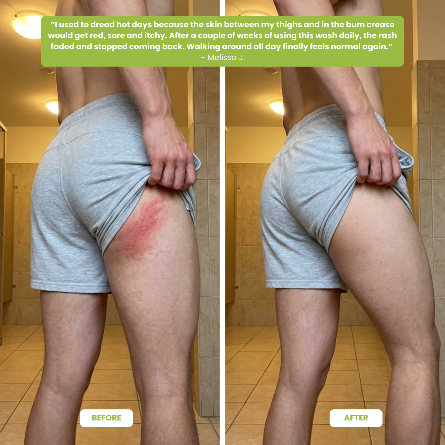 Tea Tree Antifungal Body Wash