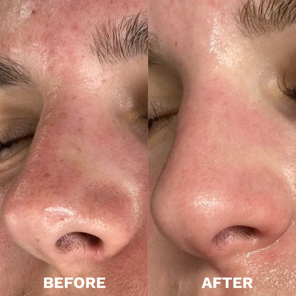 Mung Bean Skin Detox Duo
