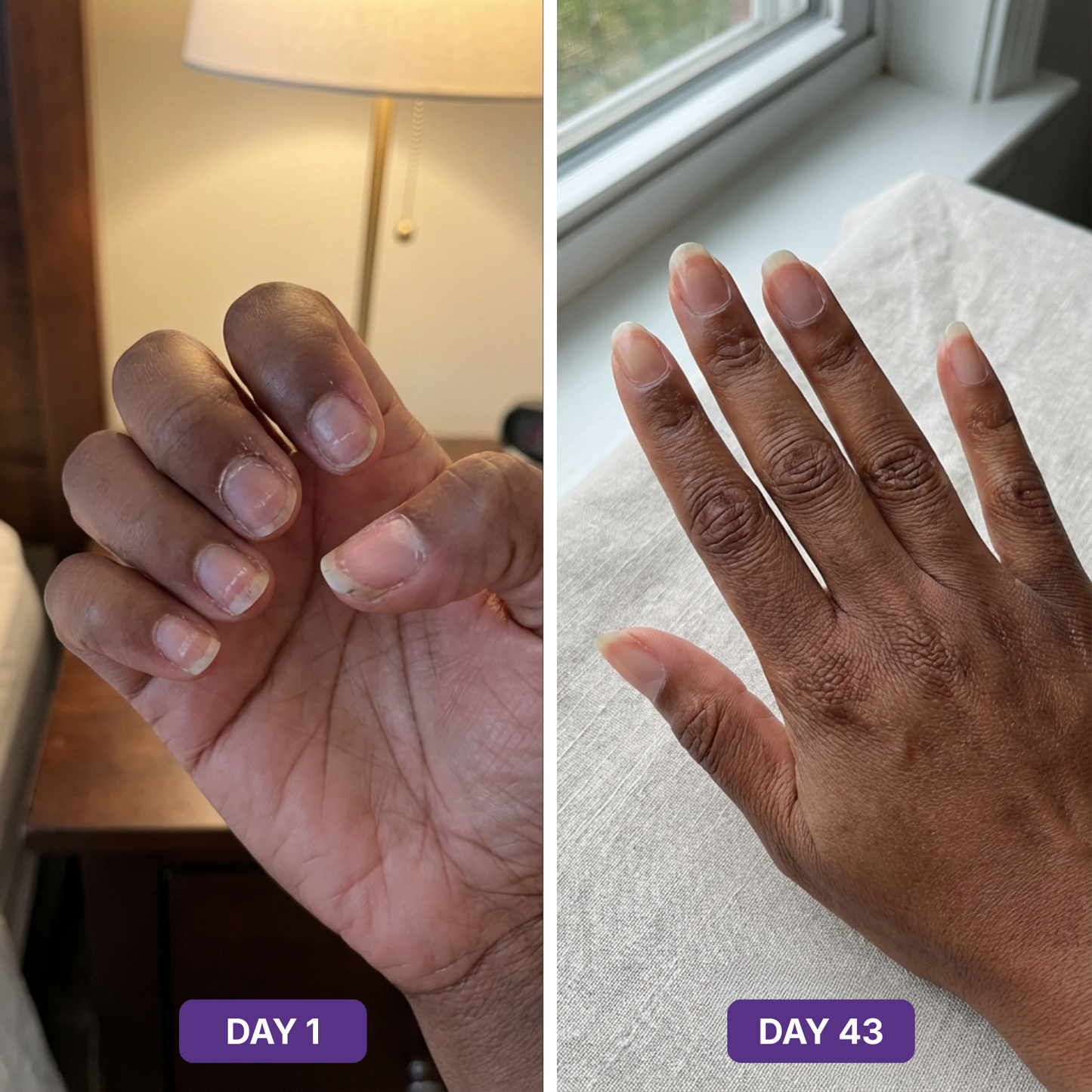 Hair Skin Nails+ Gummies 9-in-1
