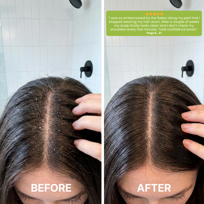 RootReset Rosemary & Mint Scalp Scrub