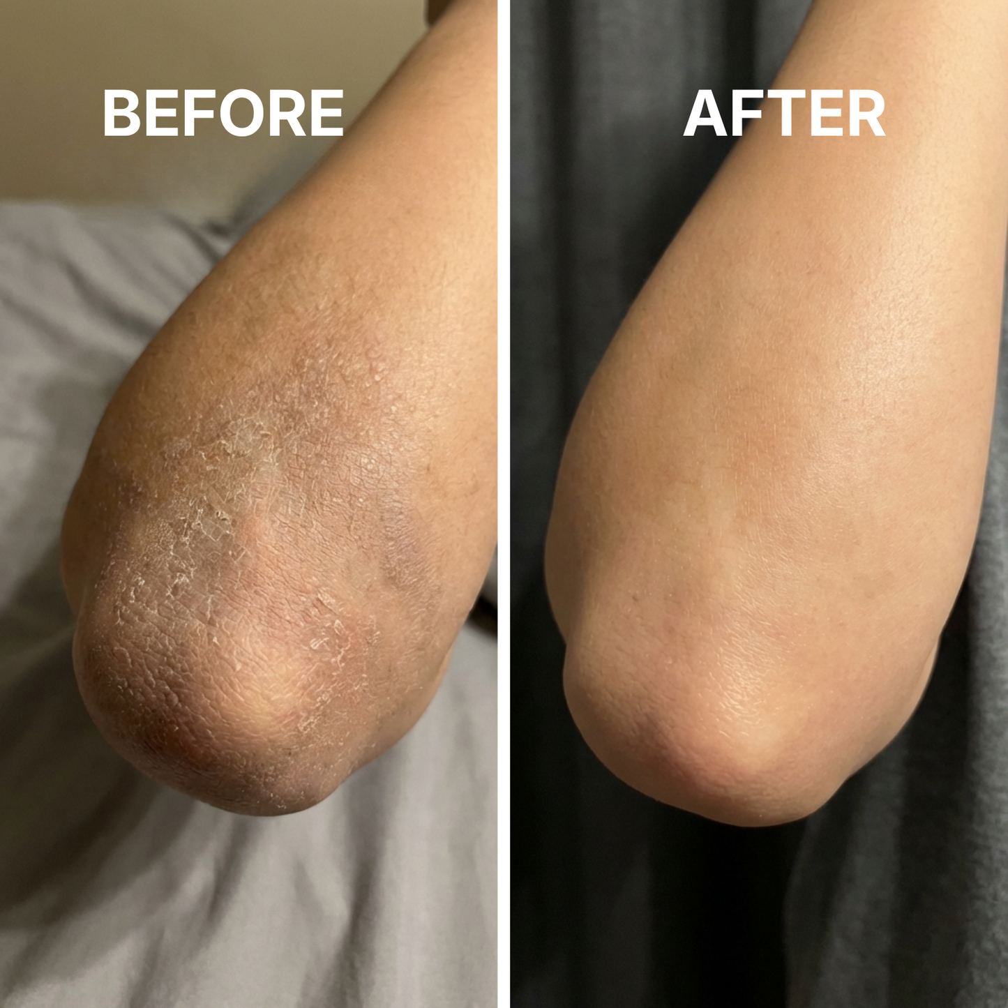 SkinFix - Target cracked, rough skin fast. Wake up to softer skin.