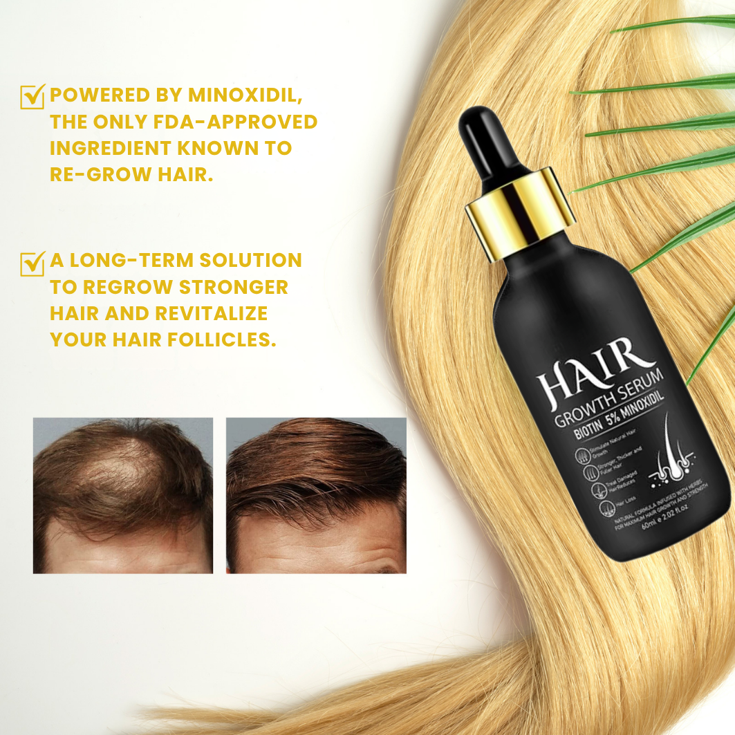 GrowthFuel™ – Hair & Beard Serum 5% Minoxidil