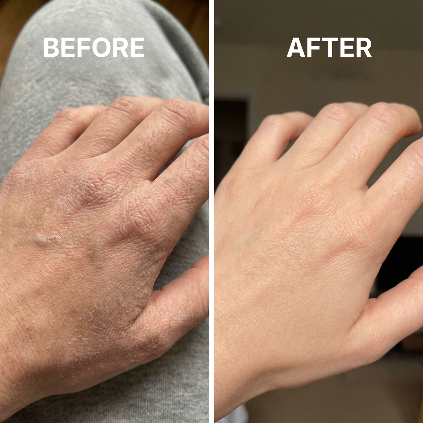 SkinFix - Target cracked, rough skin fast. Wake up to softer skin.