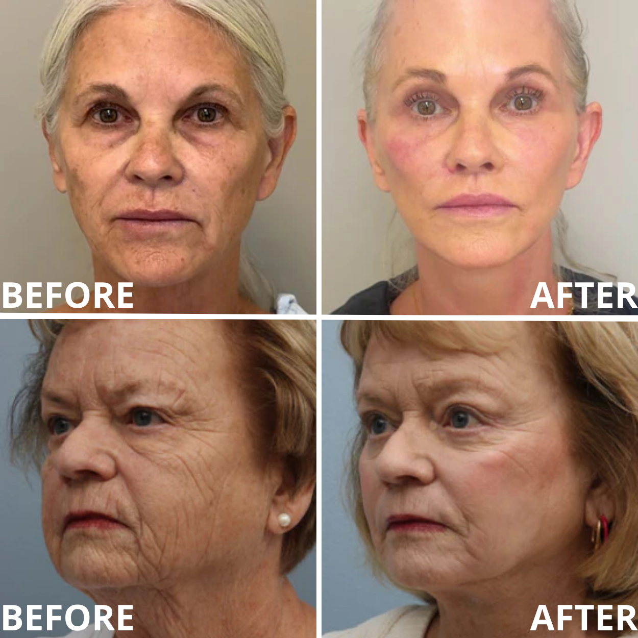 Cemenrete Calcium Multi Balm