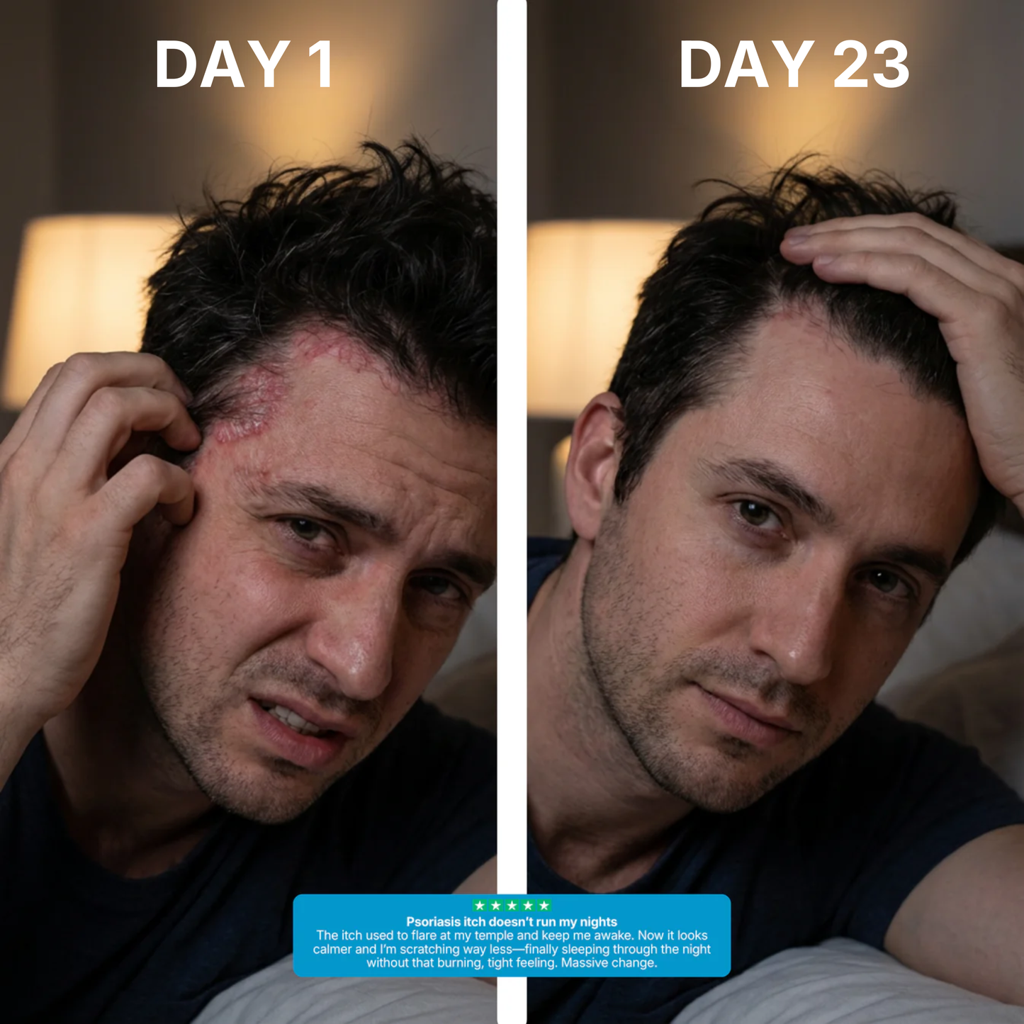 CalmDerm - Stop the itch. Stop the flakes. Feel normal again.