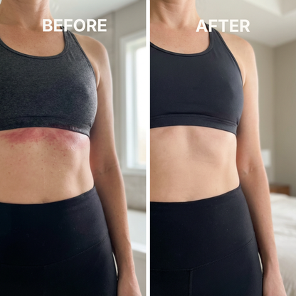 ClearSkin™ - Target skin-fold irritation from the first use.