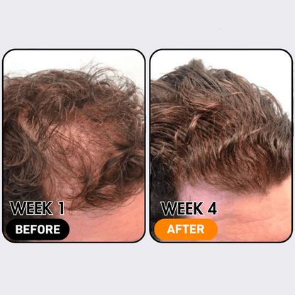 SylkRoot™ Activator Shampoo
