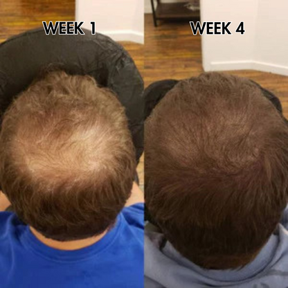 SylkRoot™ Activator Shampoo