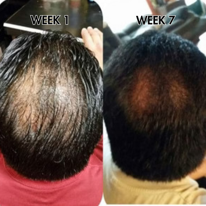 SylkRoot™ Activator Shampoo
