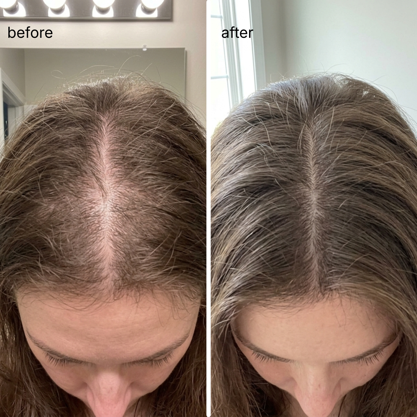 Rosemary & Rice Water Hair Growth Spray