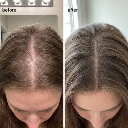 Rosemary & Rice Water Hair Growth Spray