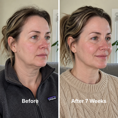 Collagen Face Mask with 24K Gold