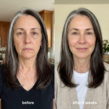 Firming Serum - EGF, NAD+ & Collagen