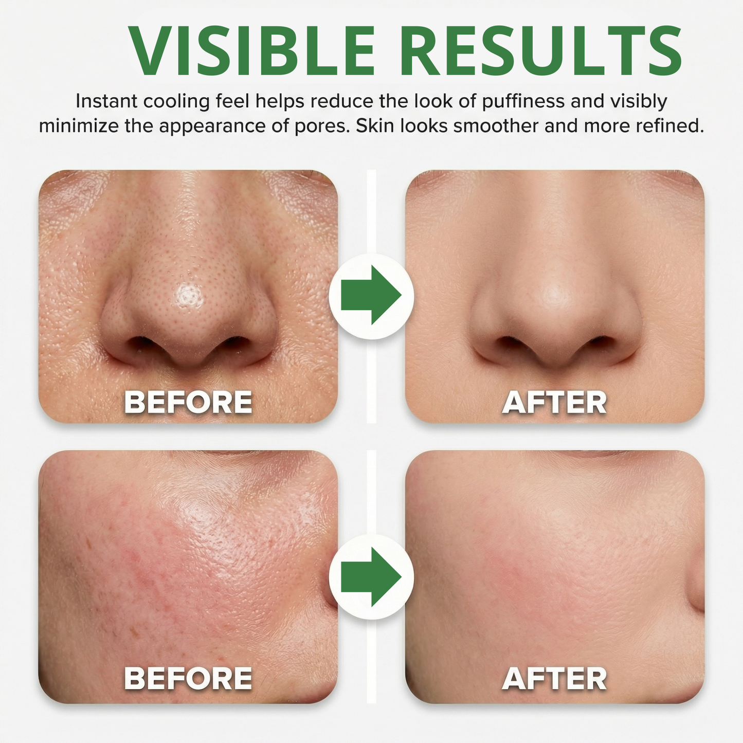 PoreRelief™ - Refines the look of pores and de puffs in 30 seconds