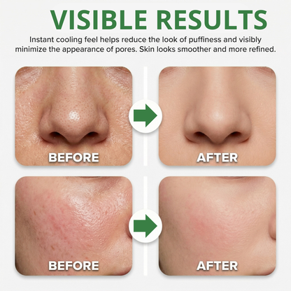 PoreRelief™ - Refines the look of pores and de puffs in 30 seconds