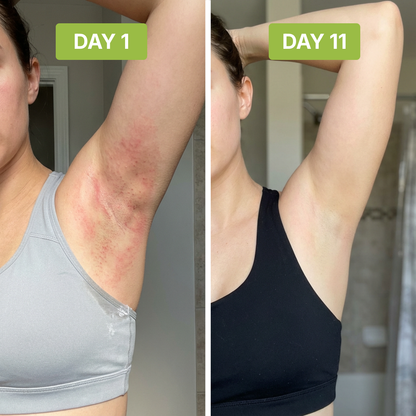 ClearSkin™ - Neutralizes Underarm Odor and Irritation.