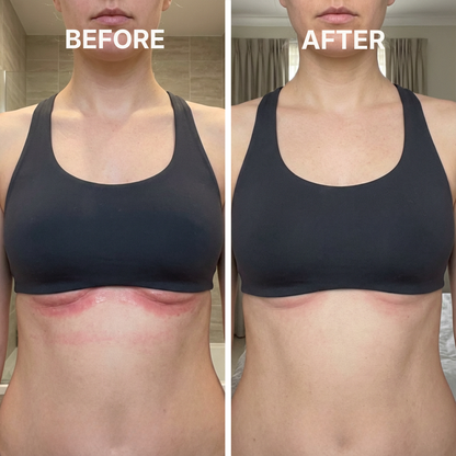 ClearSkin™ - Target skin-fold irritation from the first use.