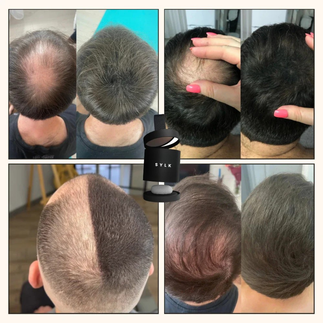 HairCover™ - Instant Hair Density in 10 Seconds