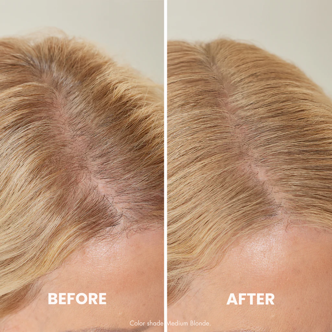 HairCover™ - Instant Hair Density in 10 Seconds