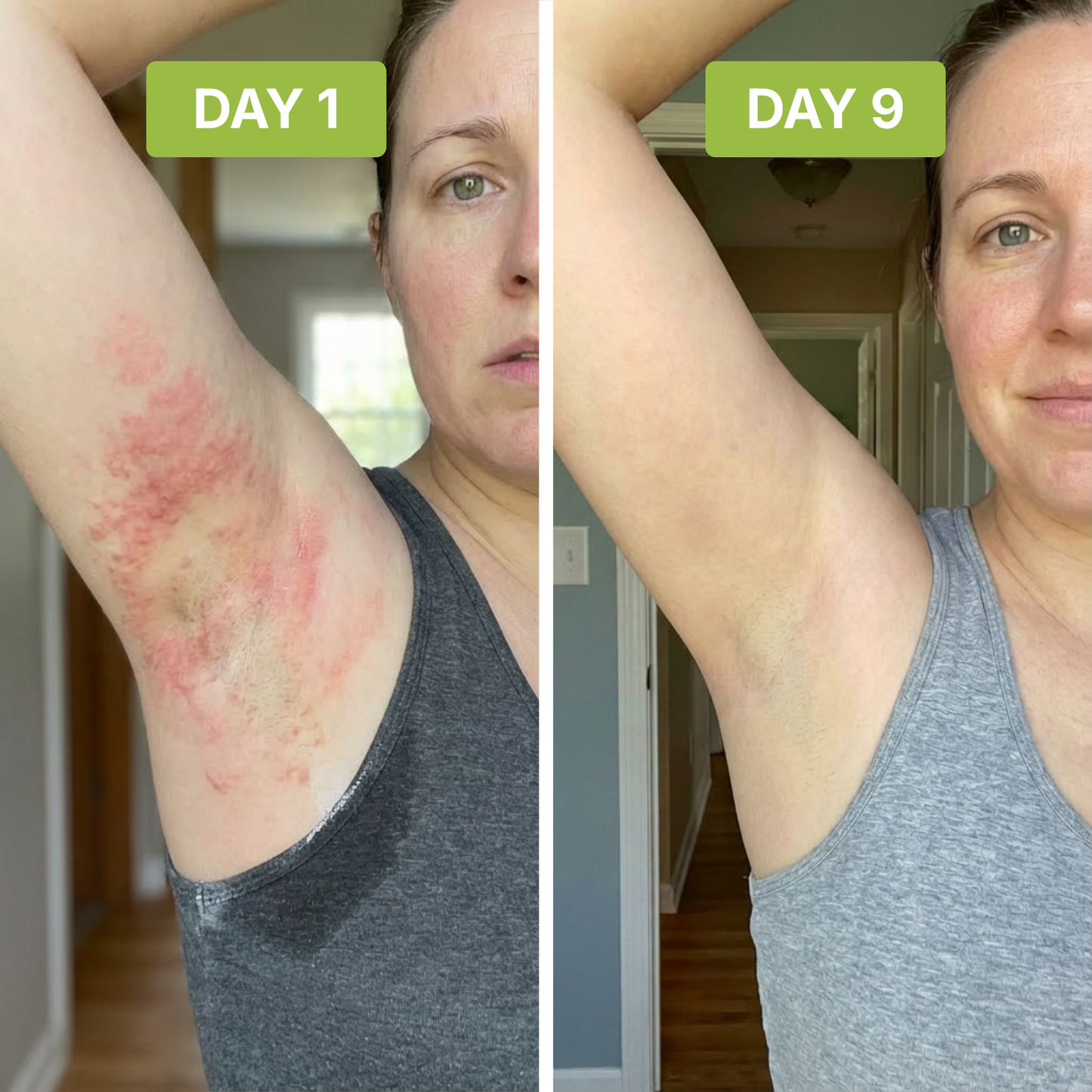 ClearSkin™ - Neutralizes Underarm Odor and Irritation.