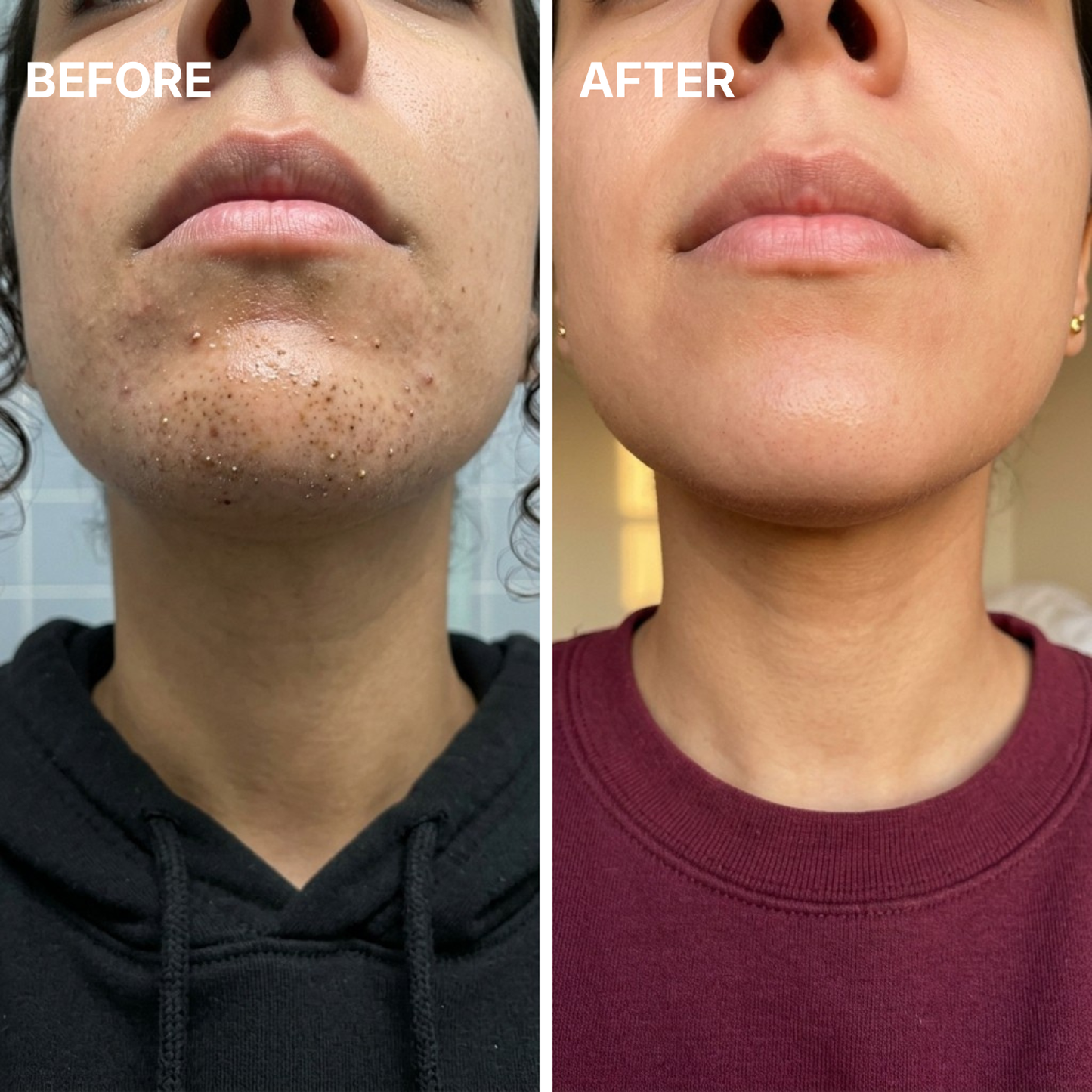 The Detox Stick™