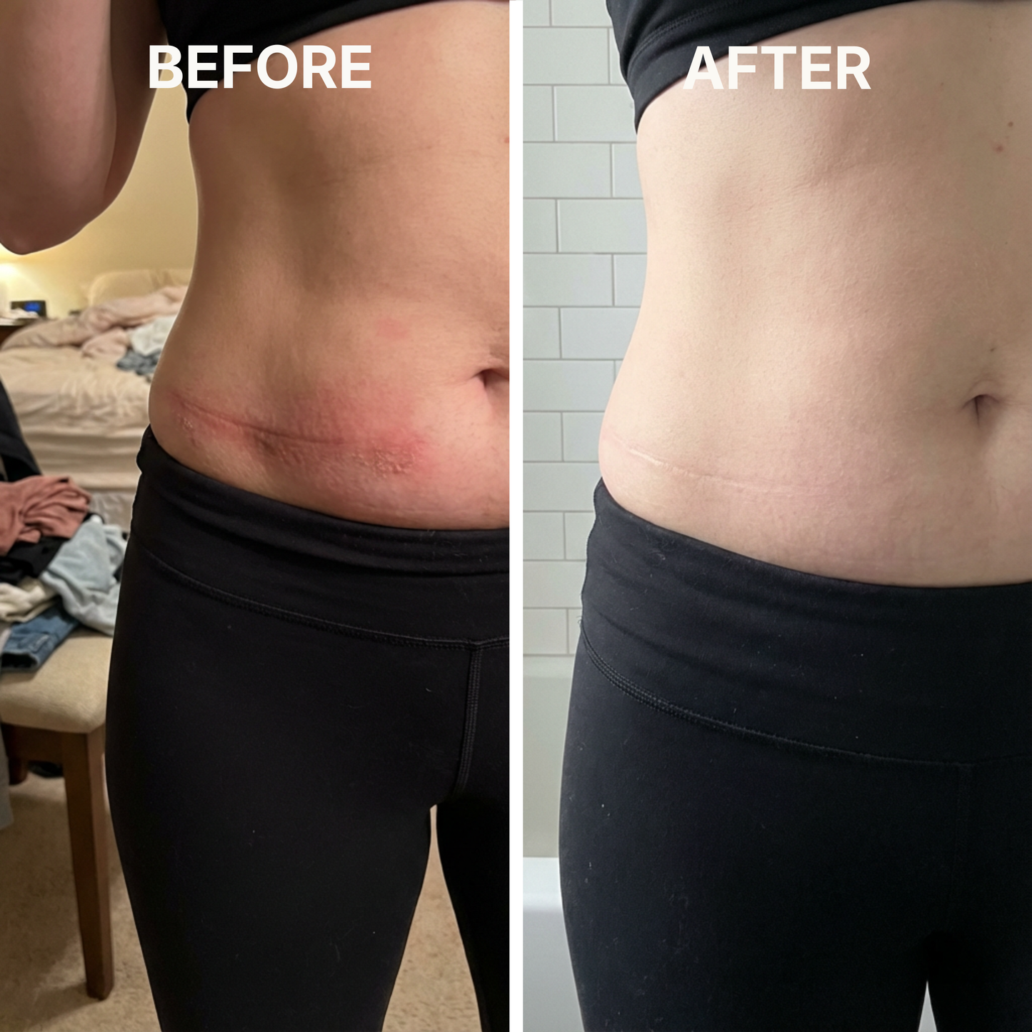 ClearSkin™ - Target skin-fold irritation from the first use.