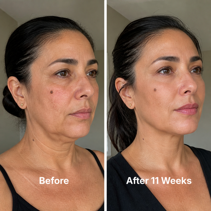 Collagen Face Mask with 24K Gold