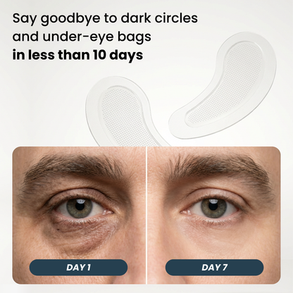 SYLK Microneedle Patches