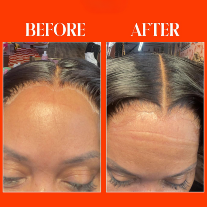 MeltGuard™ Lace Spray — Flawless Melt, No White Cast