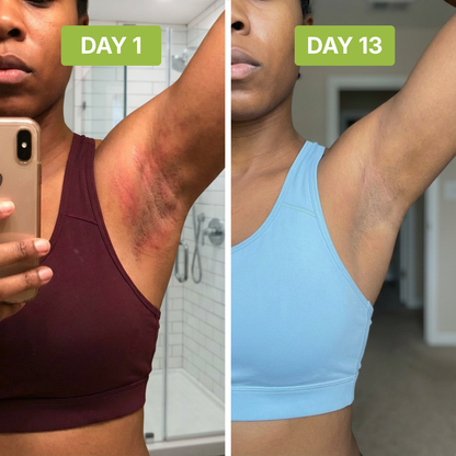 ClearSkin™ - Neutralizes Underarm Odor and Irritation.