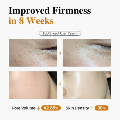DermiShuttle™ Lifting Kit