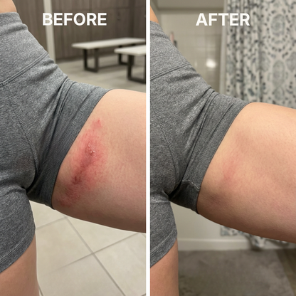 ClearSkin™ - Target skin-fold irritation from the first use.